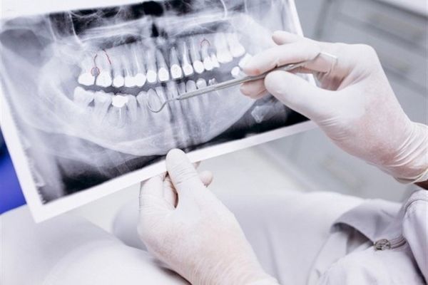 بررسی ادعای کمبود دندانپزشک در ایران