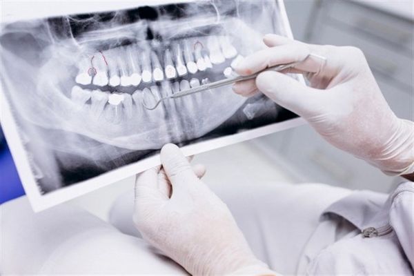 بررسی ادعای کمبود دندانپزشک در ایران