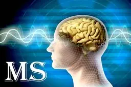 سردرگردانی بیماران ام.اس درپی توقف توزیع داروی اکتووکس