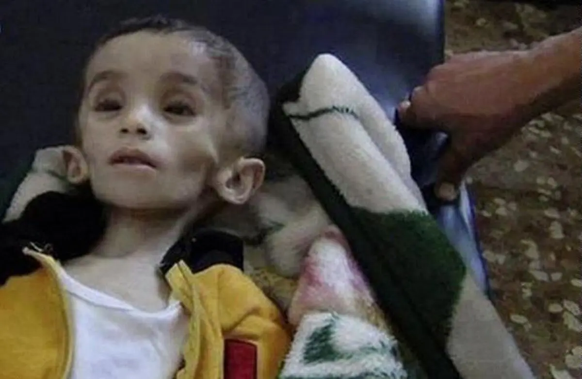 سازمان ملل: گرسنه نگه داشتن مردم در سوریه جنایت جنگی است