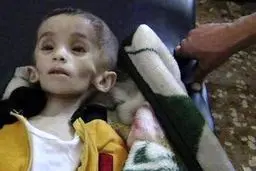 سازمان ملل: گرسنه نگه داشتن مردم در سوریه جنایت جنگی است