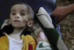 سازمان ملل: گرسنه نگه داشتن مردم در سوریه جنایت جنگی است