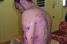 شکنجه مخالفان السیسی با شوک الکتریکی