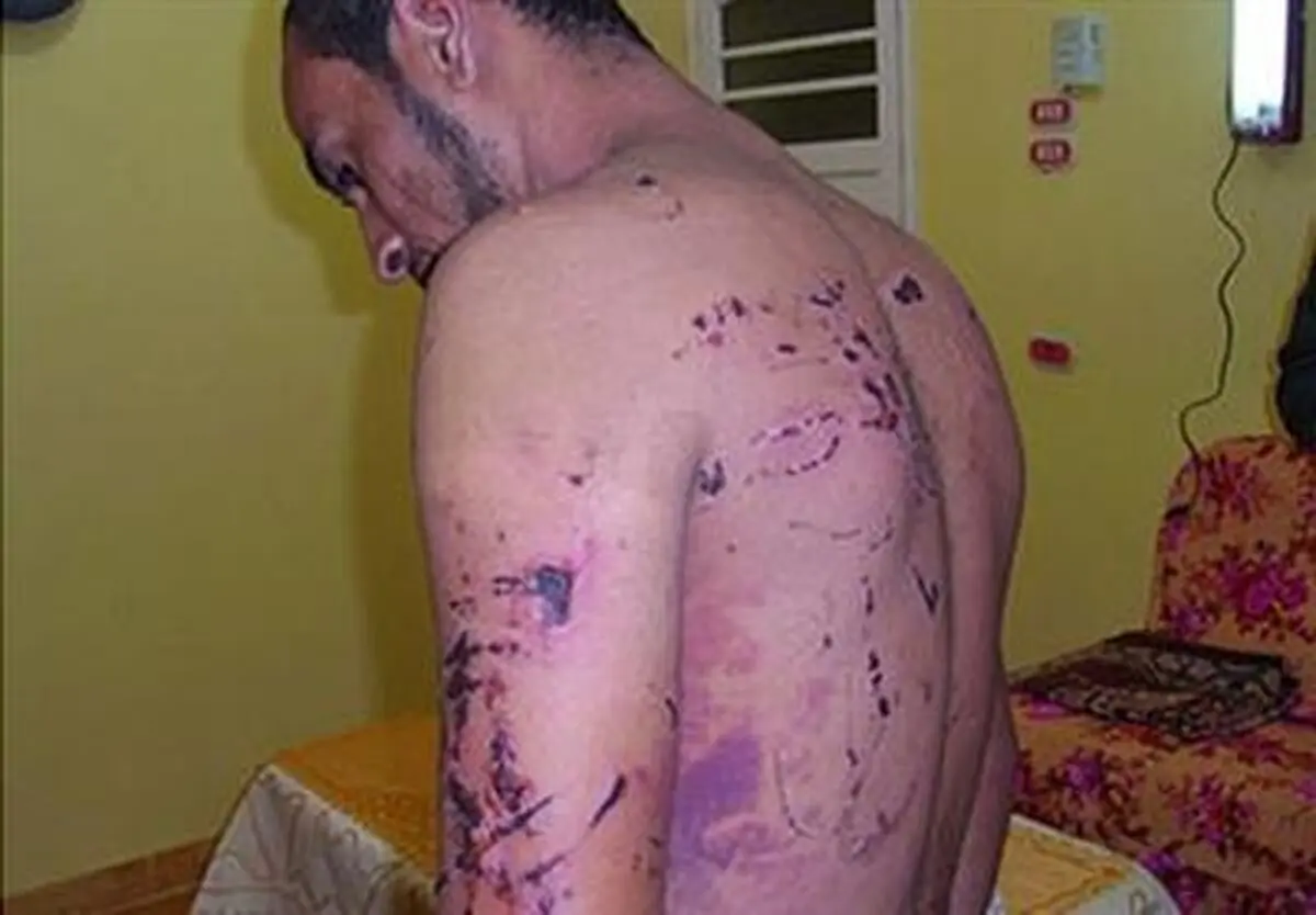 شکنجه مخالفان السیسی با شوک الکتریکی