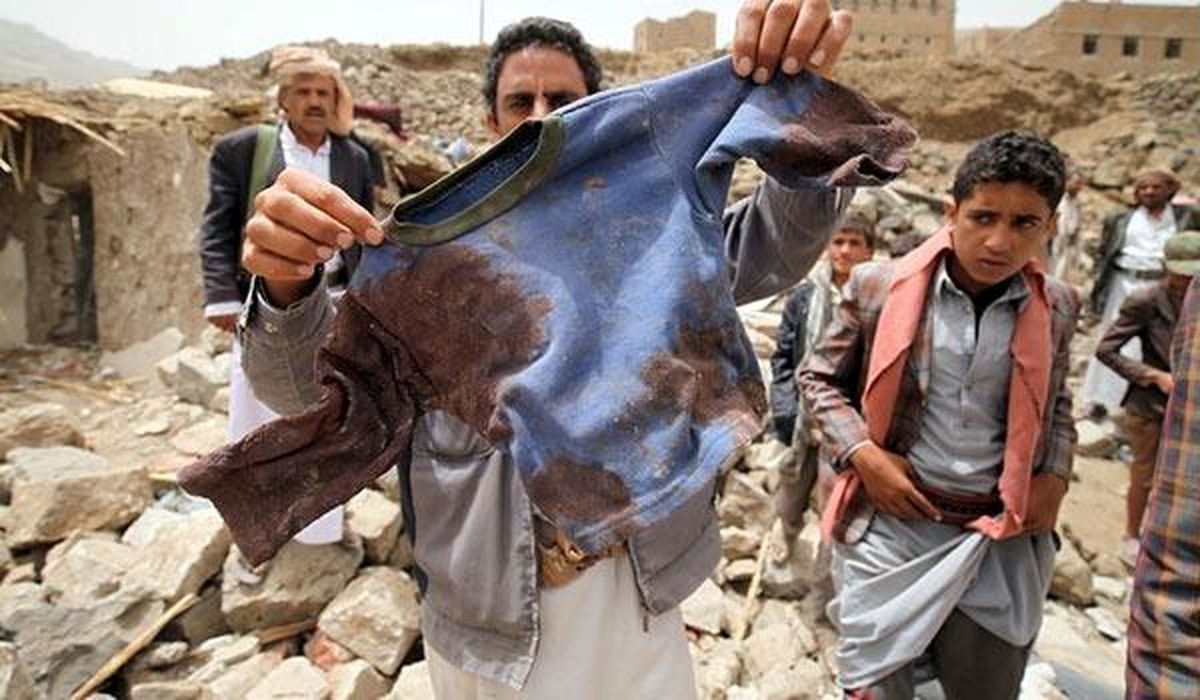 سازمان ملل: ۲ هزار کودک از آغاز جنگ یمن کشته و زخمی شده‌اند