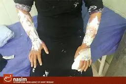 اولین تصاویر از حمله شیمیایی داعش به منطقه شیعه نشین 