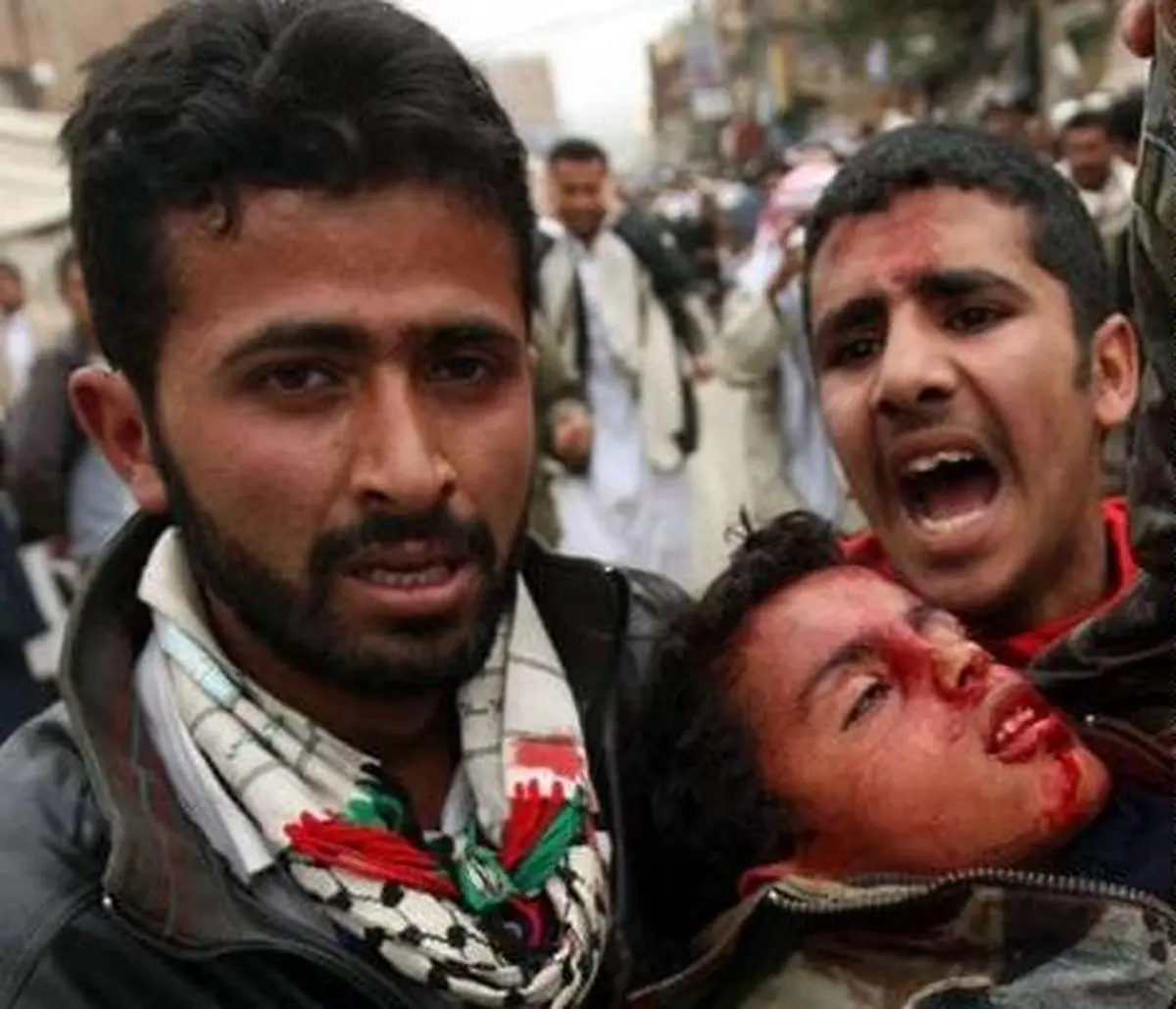 مردم یمن زیر حملات عربستان و گروه‌های تکفیری