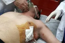 حمله مسلحانه مالکان بنای غیرمجاز به مأموران شهرداری+تصاویر