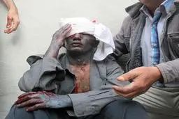 افزایش مجروحان حوادث چهارشنبه سوری به ۲۷ نفر