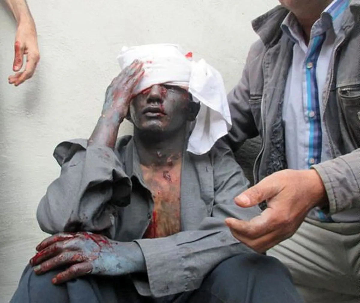 افزایش مجروحان حوادث چهارشنبه سوری به ۲۷ نفر