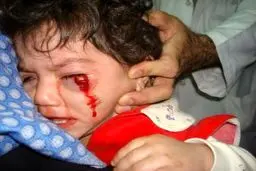 انتقال ۱۰۵ نفر مصدوم از ناحیه چشم به بیمارستان فارابی/ تخلیه چشم تا کنون نداشته‌ایم