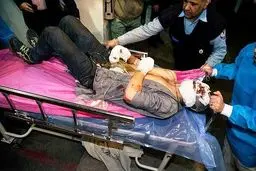 حوادث چهارشنبه سوری جان ۳ نفر را گرفت/ ۲۵۹ نفر راهی بیمارستان شدند