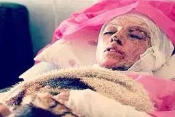 جزئیات جدید از حادثه اسیدپاشی در شمال غرب تهران