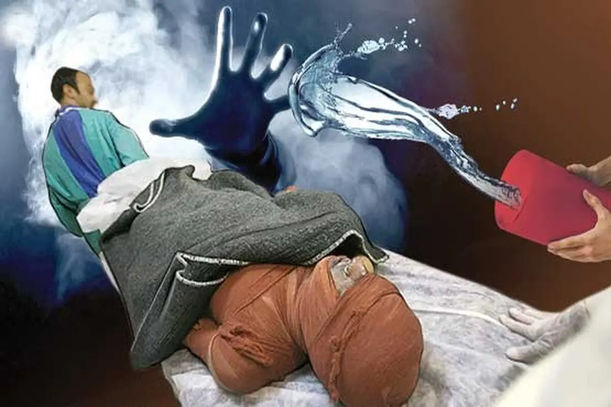 اسیدپاشی روی یک زن جوان در شرق تهران