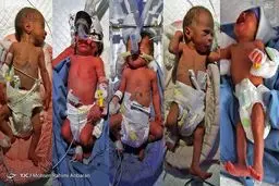 تولد ۵ قلوها در مشهد+عکس