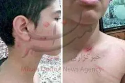 تعقیب قضایی معلمی‌که دانش‌آموز را کتک زد+عکس