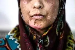 آخرین وضعیت پرونده همسرآزاری در مشهد