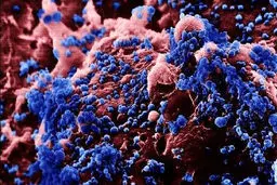 سالانه حدود ۱۵۰۰ کودک به سرطان مبتلا می‌شوند