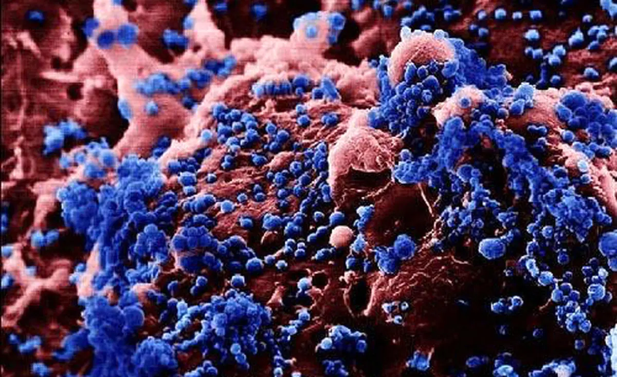 سالانه حدود ۱۵۰۰ کودک به سرطان مبتلا می‌شوند