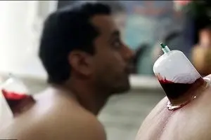 انتقال هپاتیت با 