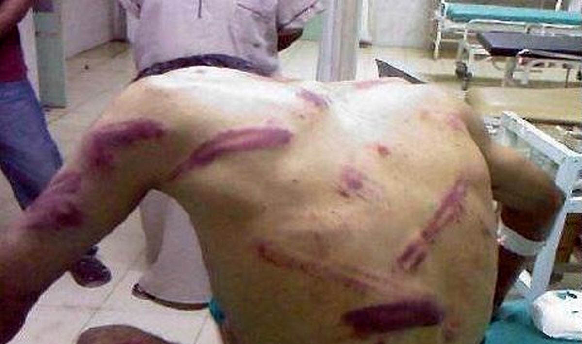 شهادت یکی از زندانیان سیاسی در بند آل‎خلیفه به دلیل شکنجه