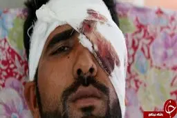 کور‌ کردن چشم معترضان کشمیری توسط نیروهای امنیتی هند