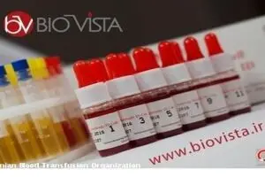 کیت تشخیصی آنتی بادی‌های غیر منتظره برای اولین بار در ایران تولید شد