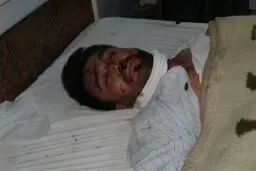 ۱۲۰ کشته و زخمی در پی حمله تروریستی به عزاداران حسینی در افغانستان
