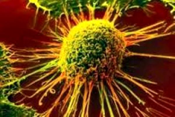تسریع فرایند تولید داروی ضد سرطان با استفاده از نانوکاتالیست مغناطیسی