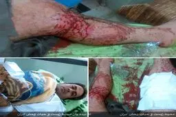 ضارب محیط بان دنا دستگیر شد