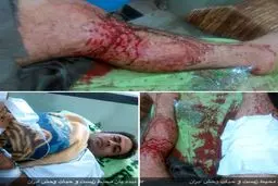 ضارب محیط بان دنا دستگیر شد