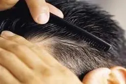 روش‌های طب سنتی در درمان سفیدی و ریزش مو