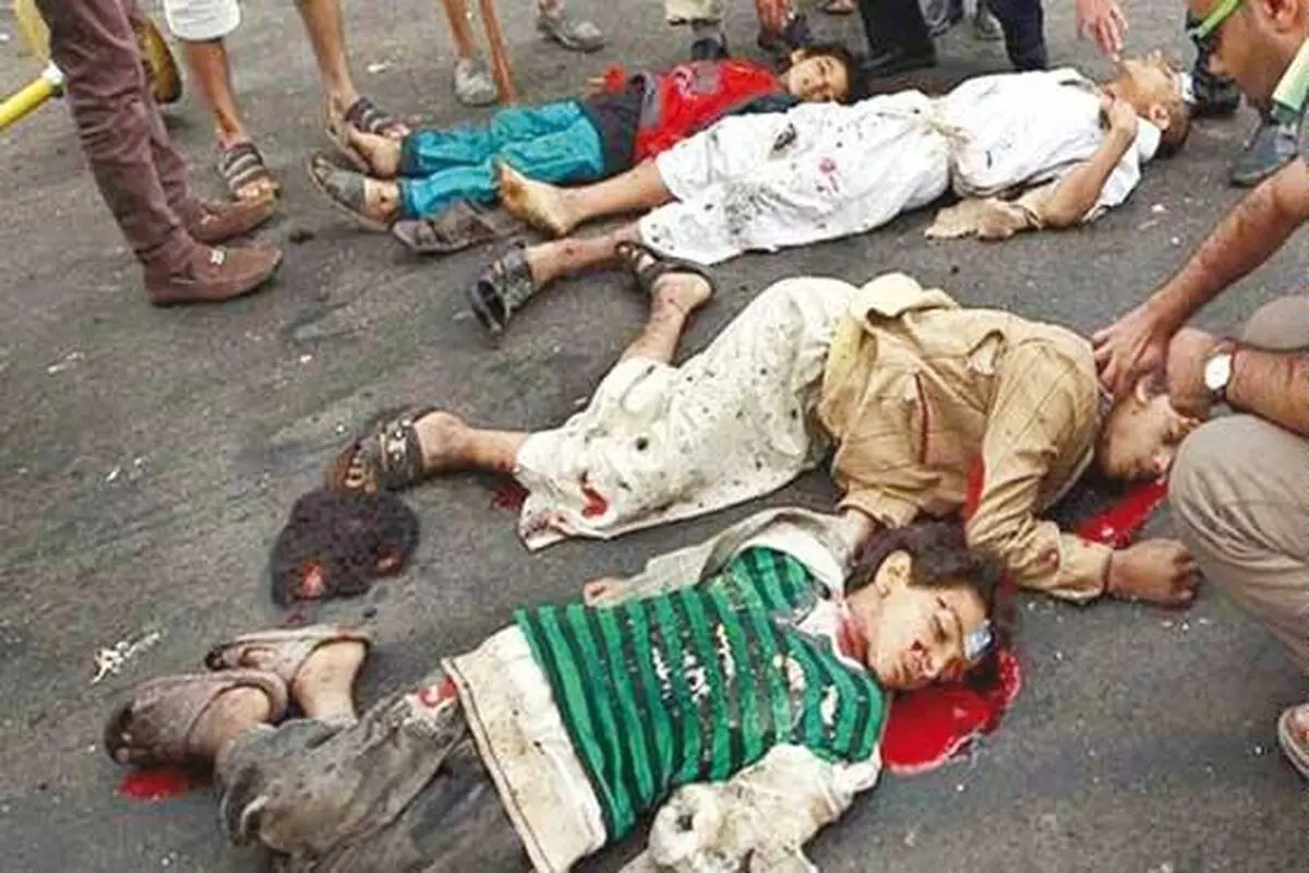 ۷۰۷۰ یمنی کشته و حدود ۳۶۸۱۶ نفر زخمی شدند