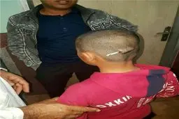 جزئیات فرو رفتن مداد در سر دانش‌آموز کرمانی