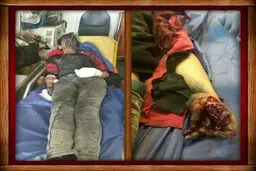 انفجار مواد محترقه پسر نوجوان را روانه بیمارستان کرد+تصویر