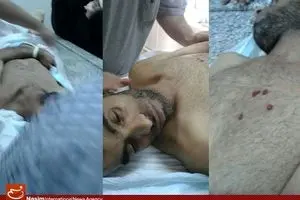 گزارش ۷ سازمان حقوق بشری درباره شکنجه در بحرین