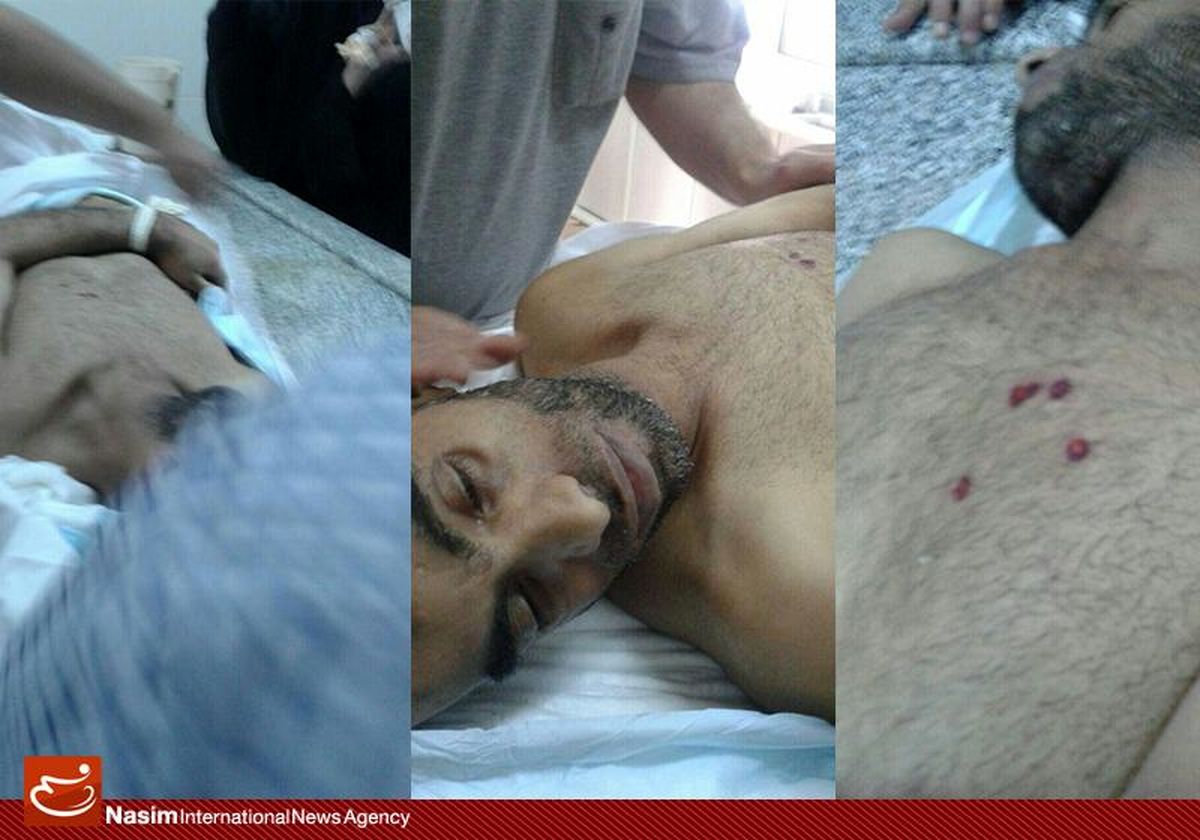 گزارش ۷ سازمان حقوق بشری درباره شکنجه در بحرین