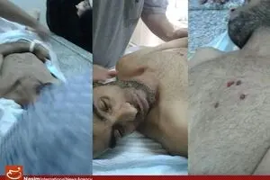 گزارش ۷ سازمان حقوق بشری درباره شکنجه در بحرین