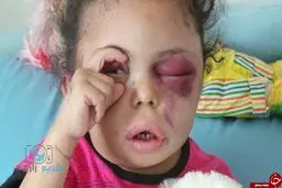 نخستین مصاحبه با کودک یمنی که جهان همراه او گریست