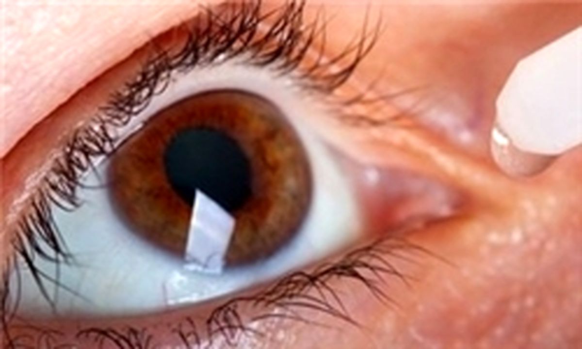 درمان بیماری های چشمی در قالب فیلم و عکس به تصویر در می‌آید