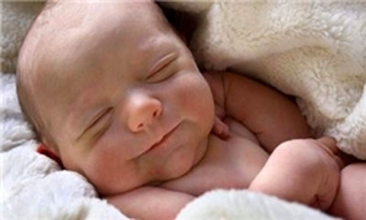۶۰ درصد نوزادان پس از تولد به زردی مبتلا می‌شوند/ علل بروز زردی نوزادان را بشناسید