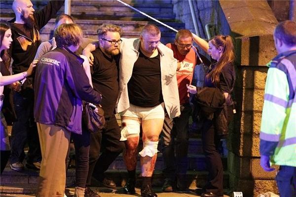 انفجار در منچستر ۱۹ کشته و ده‌ها زخمی بر جای گذاشت/ داعش مسئولیت انفجار را بر عهده گرفت + عکس و فیلم