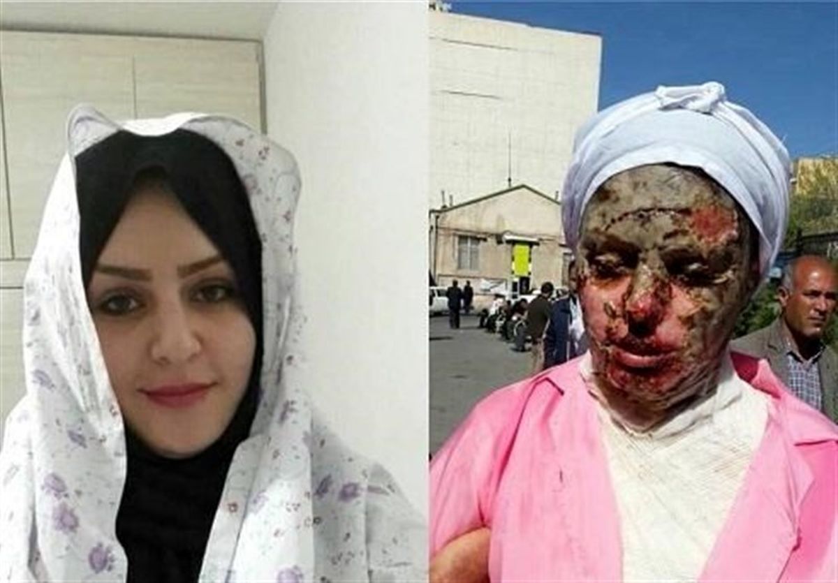 آخرین وضعیت پرونده اسیدپاشی اخیر در تبریز