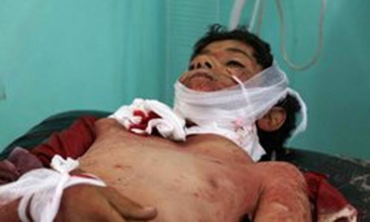 ائتلاف سعودی ۷۰ قتل عام وحشتناک در «صعده» مرتکب شده است