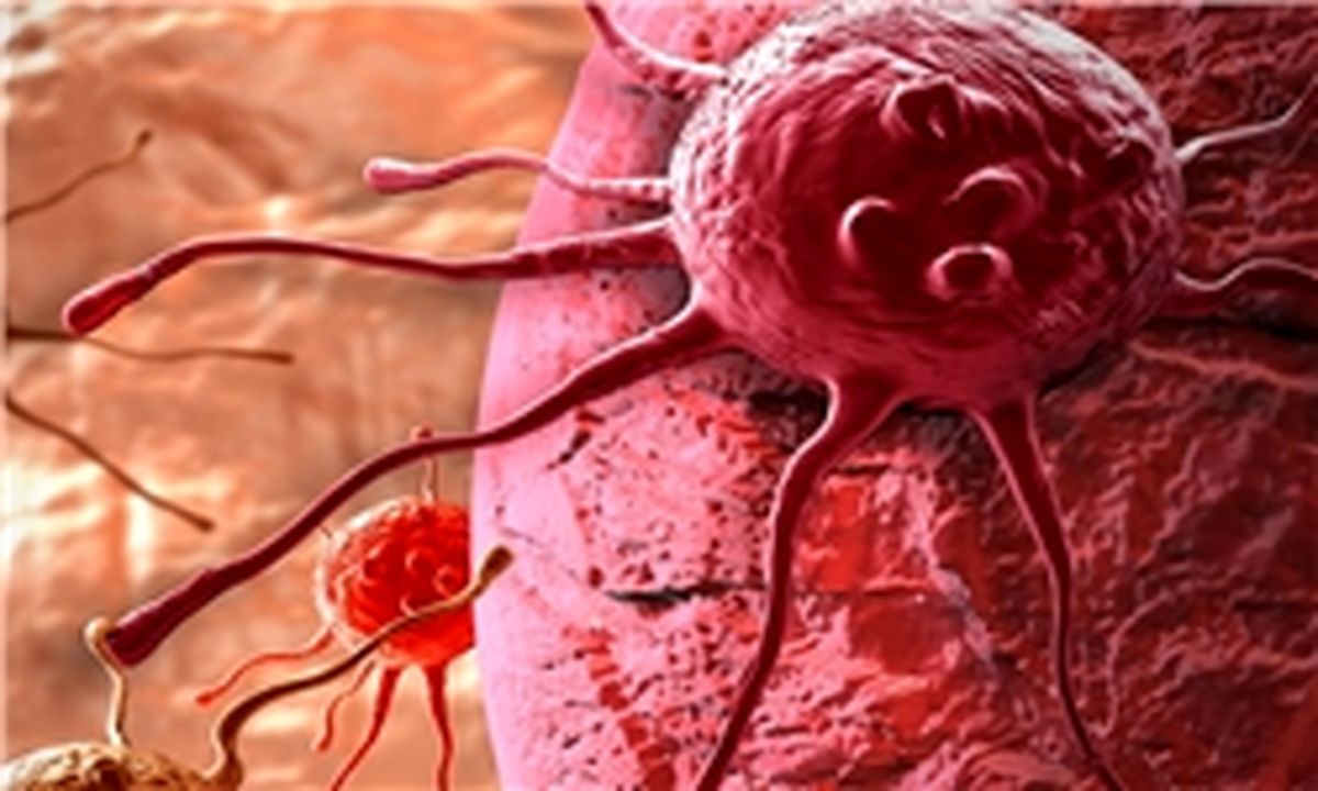 استفاده از راهنمای بالینی برای درمان سرطان/ ایمنوتراپی انقلابی در زمینه درمان سرطان