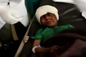 سکوت سازمان ملل در مقابل جنایات سعودی‌ها در یمن