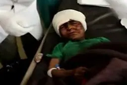 سکوت سازمان ملل در مقابل جنایات سعودی‌ها در یمن