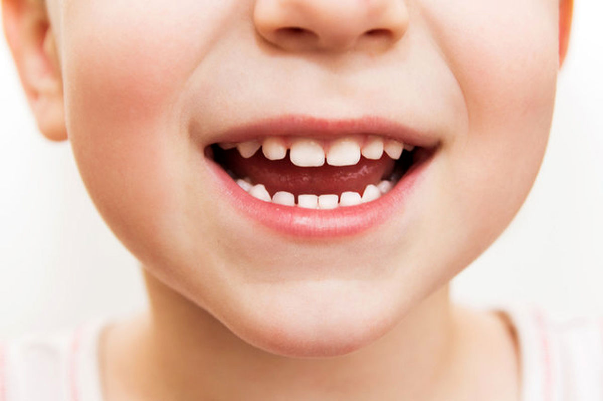 ترمیم دندان کودکان با "سلول‌های بنیادی"