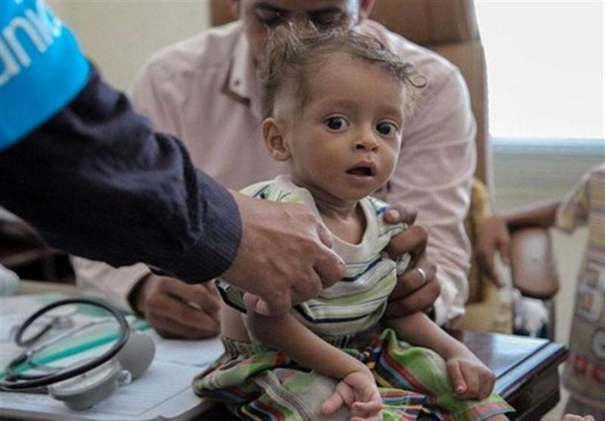هر ۱۰ دقیقه یک کودک یمنی می‌میرد!