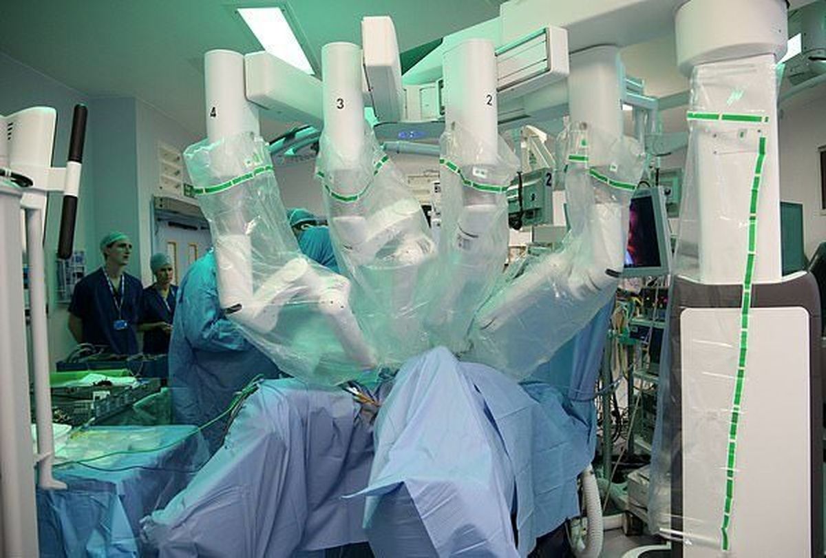 یک بیمار سرطانی توسط ۴ ربات جراحی شد